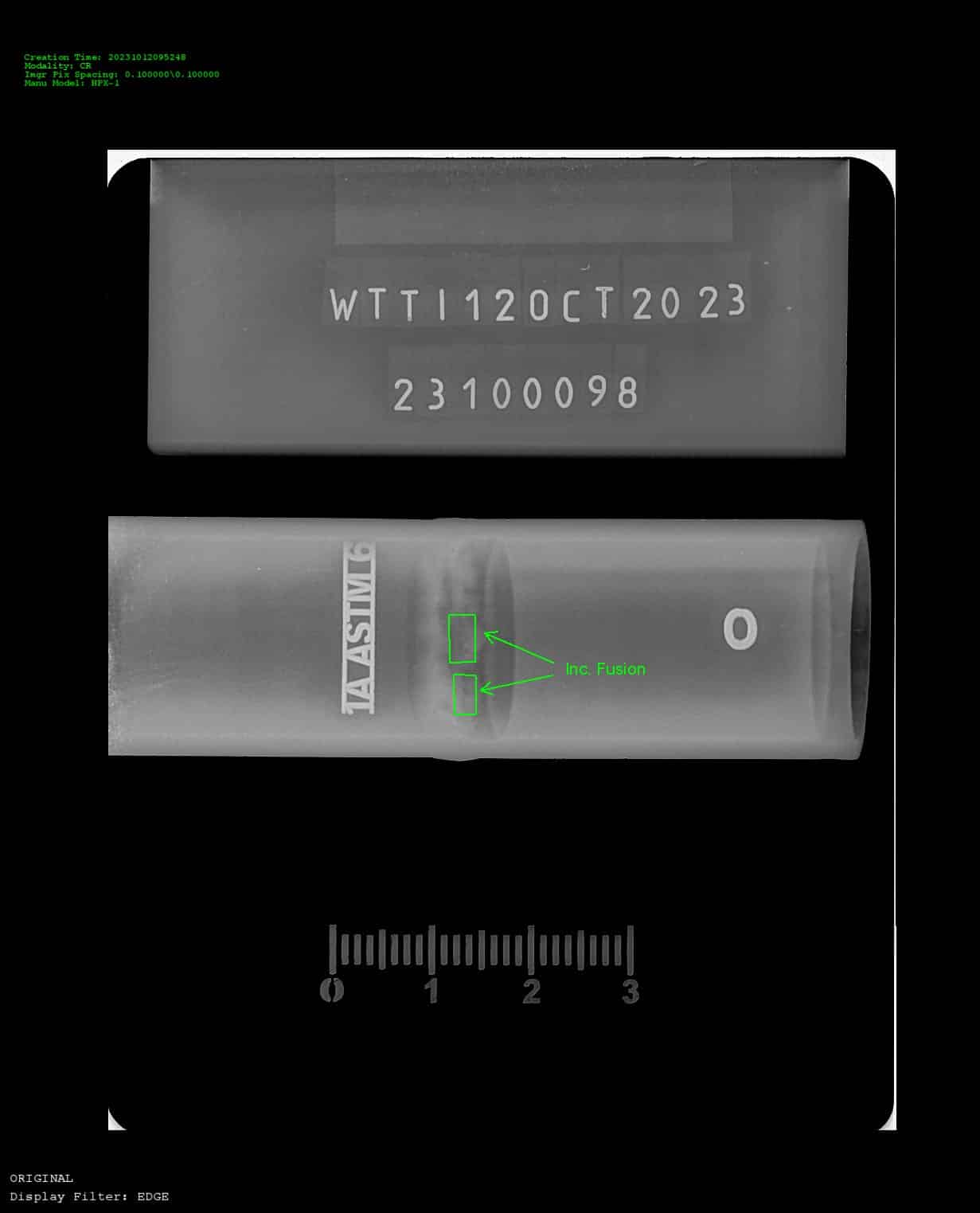 X-ray close up of metal hose